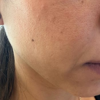 Medika Derma İzmit Hayal Kırıklığı