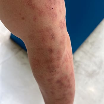 Medika Derma İzmit Hayal Kırıklığı