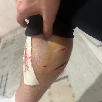 Bakırköy Belediyesi Bakırköy Başıboş Köpekler
