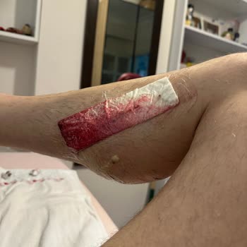 Bakırköy Belediyesi Bakırköy Başıboş Köpekler