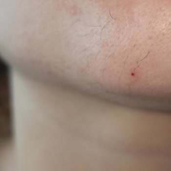 Sandra Güzellik ve Epilasyon Salonu Yüz Epilasyon İçin Gittiğim Sandra Güzellik Merkezinden Şikayetçiyim