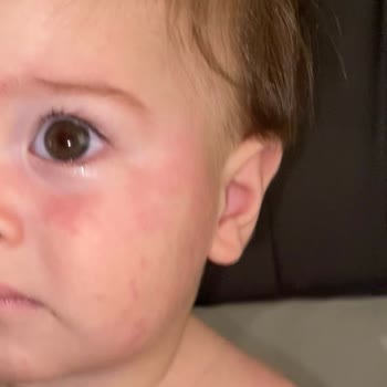 Mustela Güneş Kremi Şikayeti