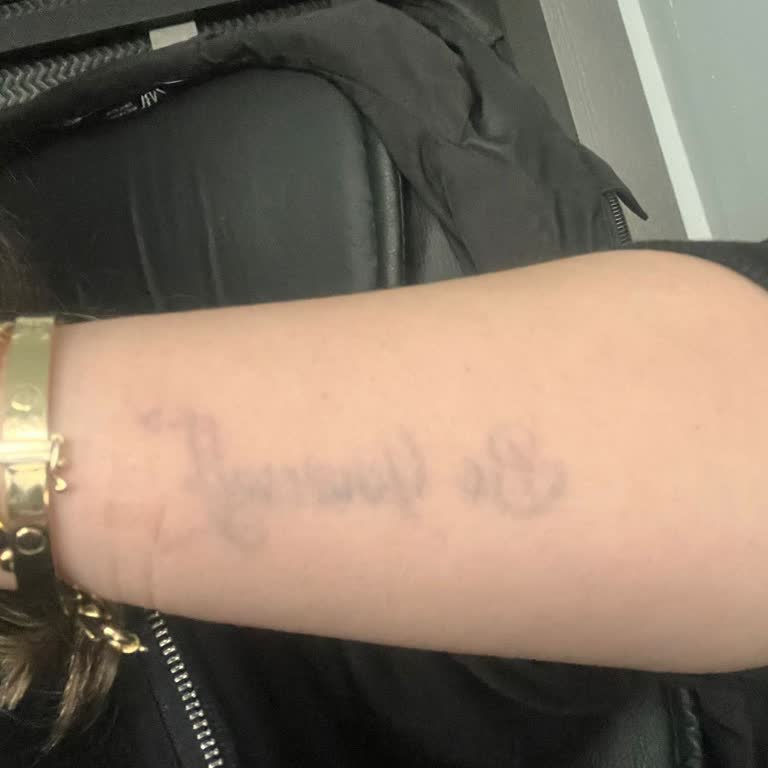 Esteworld Dövme Sildirme İşlem Sorunu