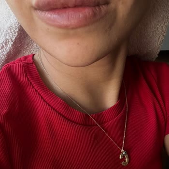 Luvimed Clinic Dudak Dolgusu İşlemi