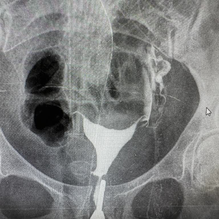 Sanko Üniversitesi Hastanesi Üniversite Hastanesinde Yaşanan Sağlık Sorunları