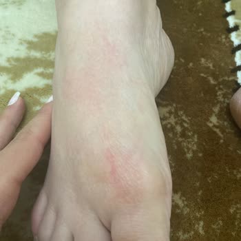 Gratis Bealius Marka Ayak Maskesinden Şikayet