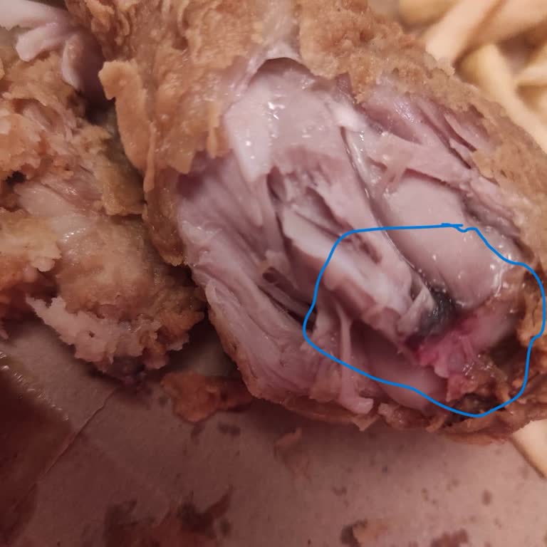 Popeyes Bozuk Ürün Gönderimi Ve İade Süreci