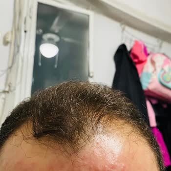 Fatoş & Gamze Beauty Bakım İçin Gittik, Sağlığımızdan Olduk