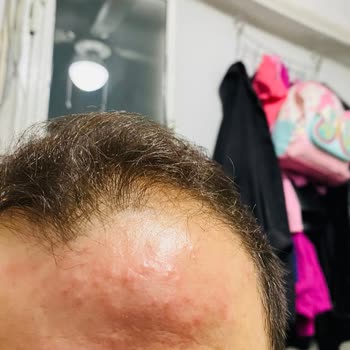 Fatoş & Gamze Beauty Bakım İçin Gittik, Sağlığımızdan Olduk