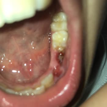 Samsun Ağız Ve Diş Sağlığı Hastanesi Doktor İhmali Hatası Ne Dersen De Sözde Doktor