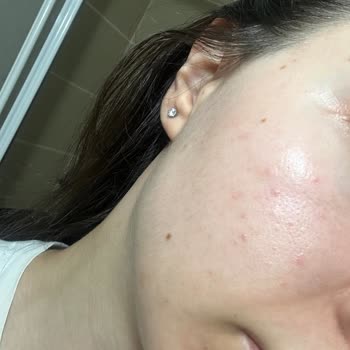 Yves Rocher Cilt Sağlığımla Oynadı