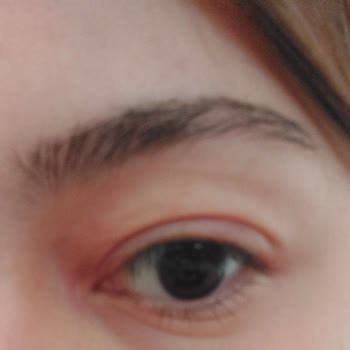 Konya M1 AVM Atasun Optik Lens Suyu Gözlerimi Tahriş Etti