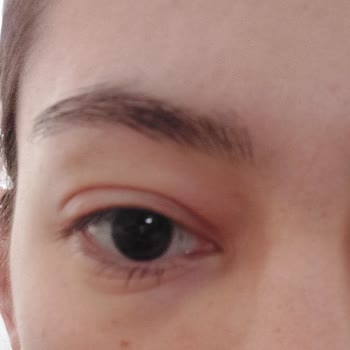 Konya M1 AVM Atasun Optik Lens Suyu Gözlerimi Tahriş Etti