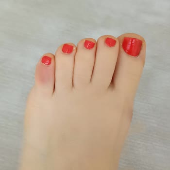 Birkenstock Terlikler Ayağımı Yara Yaptı