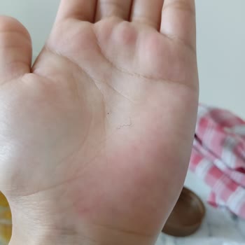 Gürsoy Fındık Tel Cıktı İçinden