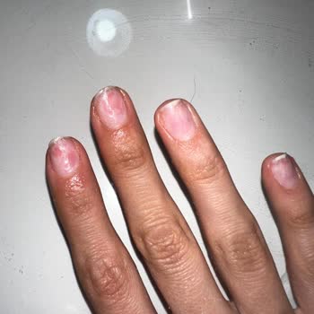 Lotus Protez Tırnak Şikayetim