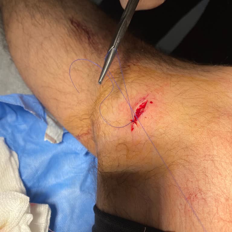 Aliağa Tıp Merkezinin Kanamalı Yaralanmama Müdahale Etmemesi