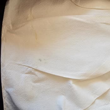 Peony Collective Lekeli Ve Görselinden Basit Gelen Ürünü Geri Almıyor!