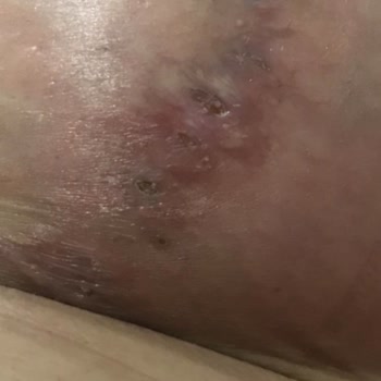 Horrible Experience with Estetica