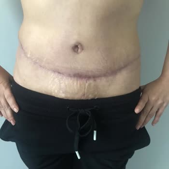 Horrible Experience with Estetica