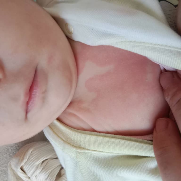 Mustelanin Nemlendirici Kremi