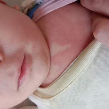 Mustelanin Nemlendirici Kremi