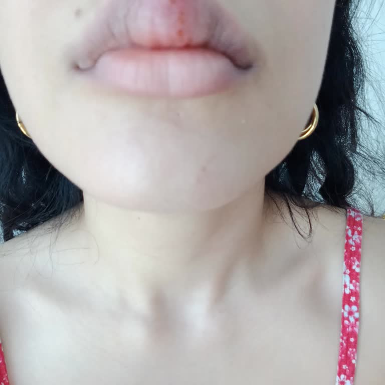 Sultan Tutuş'da Yaptırdığım İşlem İşe Yaramadı