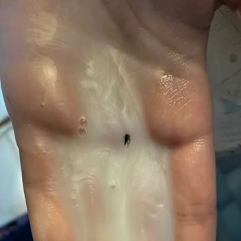 BİM Capitol Şampuanının İçinden Böcek Çıktı