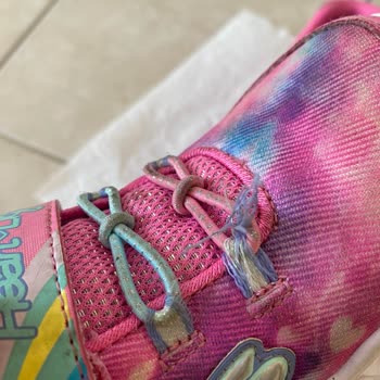 Skechers Çocuk Ayakkabısı Sorunu