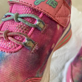 Skechers Çocuk Ayakkabısı Sorunu