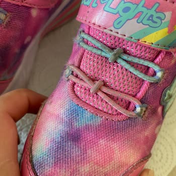 Skechers Çocuk Ayakkabısı Sorunu