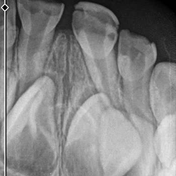 MHRS - 182 Gidilmiş Randevuya Gitmemiş Gibi Gözükmek