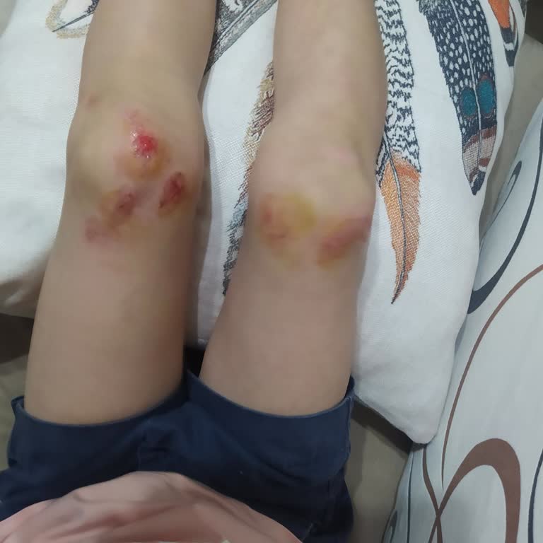 İzmir Büyükşehir Belediyesi Acilen Çözüm Bulunması Lazım