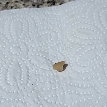 A101 Sorumsuzca Paketlenen Ürün Yüzünden Ön Dişimin Kırılması