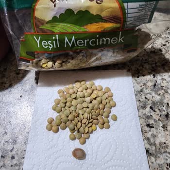 A101 Sorumsuzca Paketlenen Ürün Yüzünden Ön Dişimin Kırılması