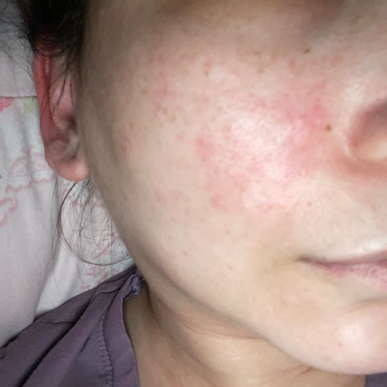 Loreal Paris Koruyucu Güneş Kremi