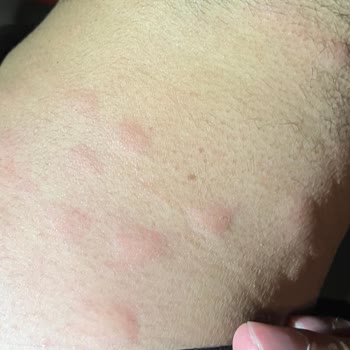 Süha Turizm Böceklerin İstilasına Uğramış Bakımsız Araç