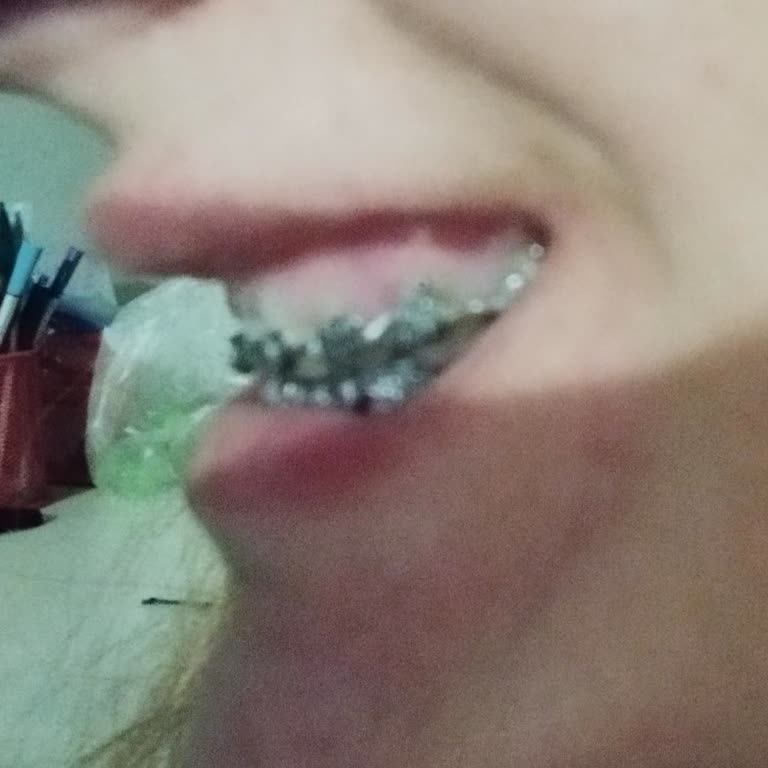 Medipol Sağlık Grubu Ankara Medipol Ortodonti Şikayet