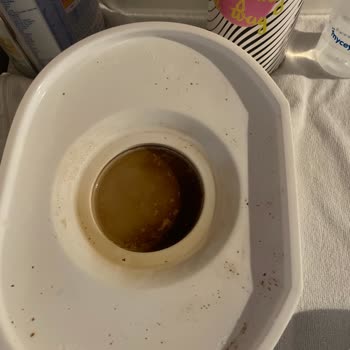 Chicco 3&1 Arada Sterilizatör Yanık Kokusu Ve Kararma Kötü Ürün