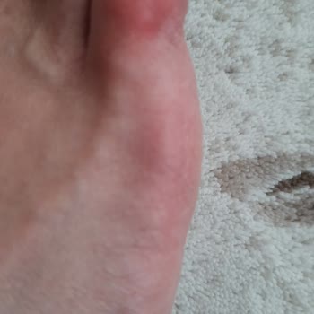 Greyder Ayakkabının İmalatından Kaynaklanan Hatası