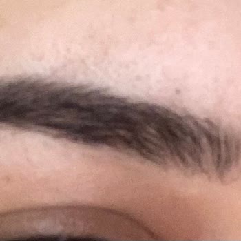 Nez Demir Microbiling İşlem Hatası