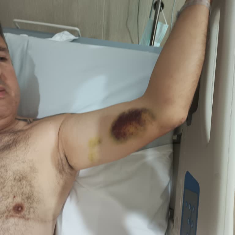 Yurt Dışında Kazayı HDI Seyahat Sigortası Sigortası Karşılamıyor.!