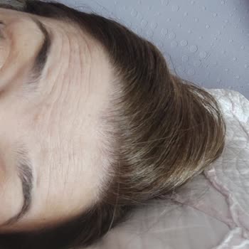 Dr. Mehmet Akgün Sonuç Alınamayan Uygulamanın İadesi