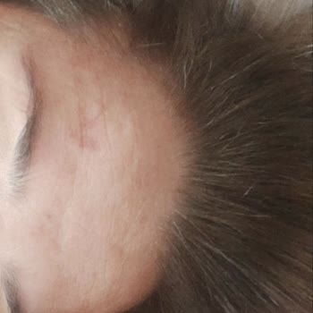 Dr. Mehmet Akgün Sonuç Alınamayan Uygulamanın İadesi