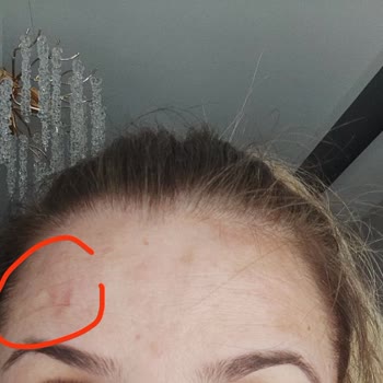 Dr. Mehmet Akgün Sonuç Alınamayan Uygulamanın İadesi