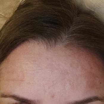 Dr. Mehmet Akgün Sonuç Alınamayan Uygulamanın İadesi