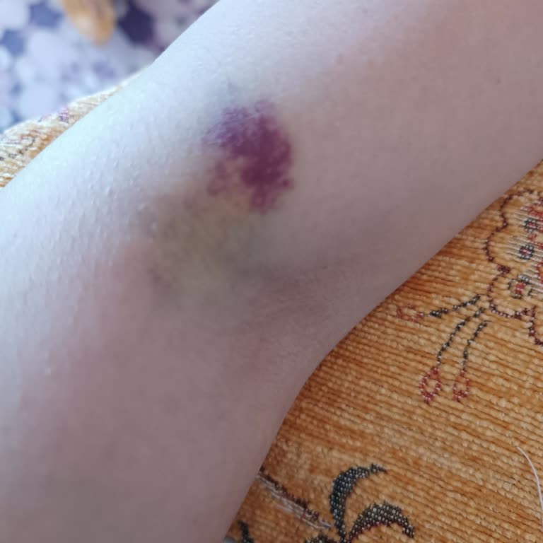 Cizre Devlet Hastanesi Biraz Daha Dikkatli Olmanızı Diliyoruz