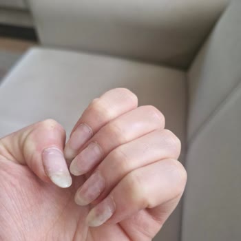 Fatma Sezgin Güzellik Jel Tırnak Şikayeti