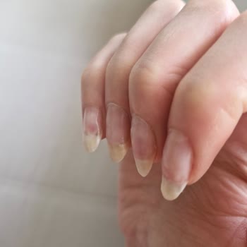 Fatma Sezgin Güzellik Jel Tırnak Şikayeti