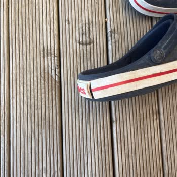 Kısa Sürede Rengi Solan Ve Deforme Olan Crocs Terlik